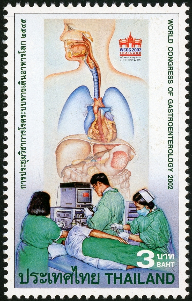 切手紹介5：タイ（2002年発行）―胃癌や大腸癌の内視鏡検査の推進