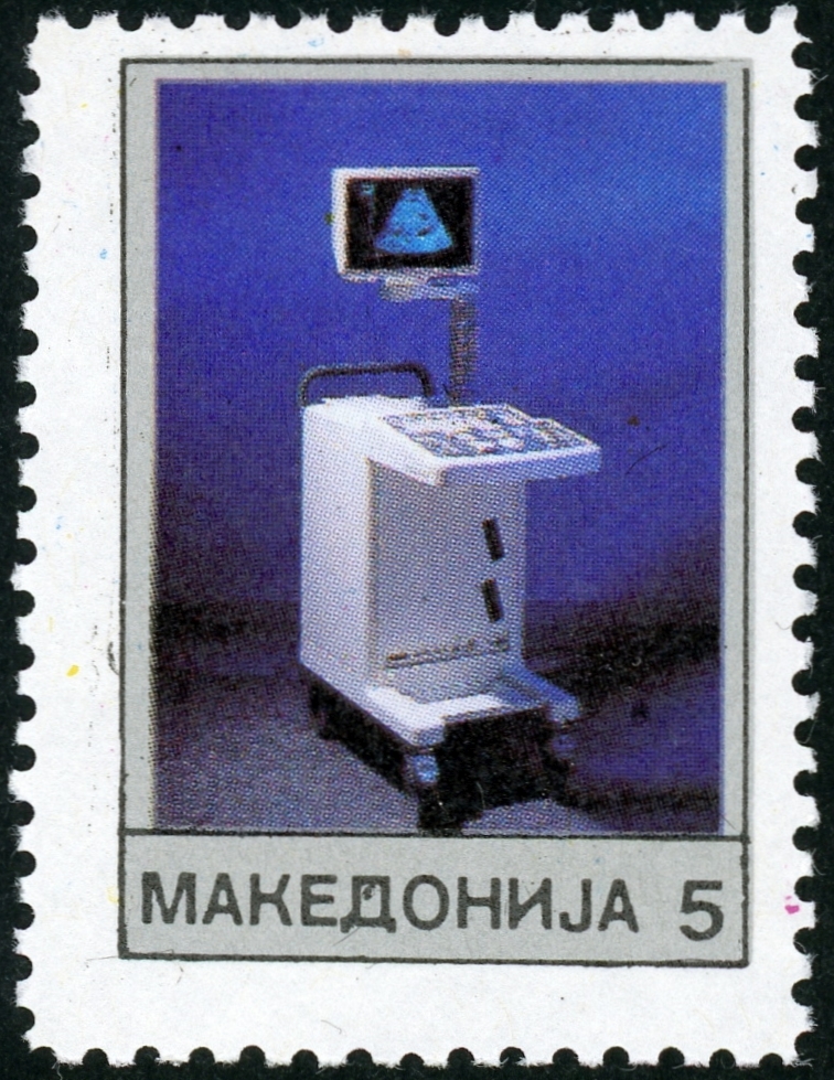 切手紹介6：マケドニア（1992年発行）―肝臓癌の早期発見と超音波診断装置