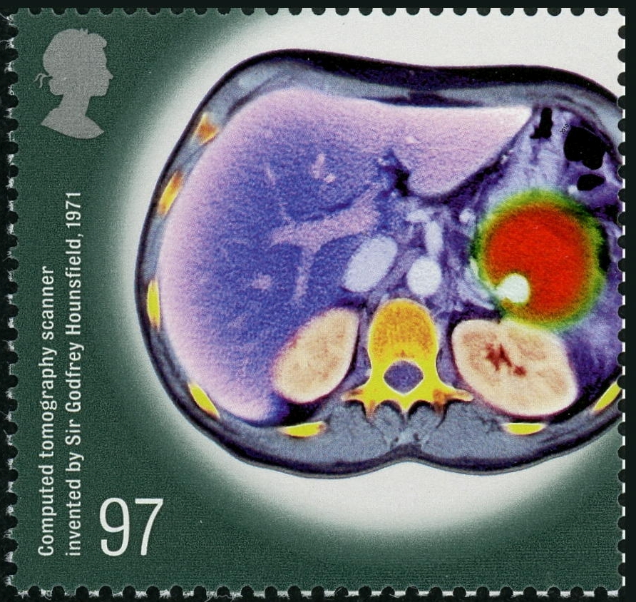 画像診断の切手：4：イギリス（2010年発行）—CTによる腹部断層写真