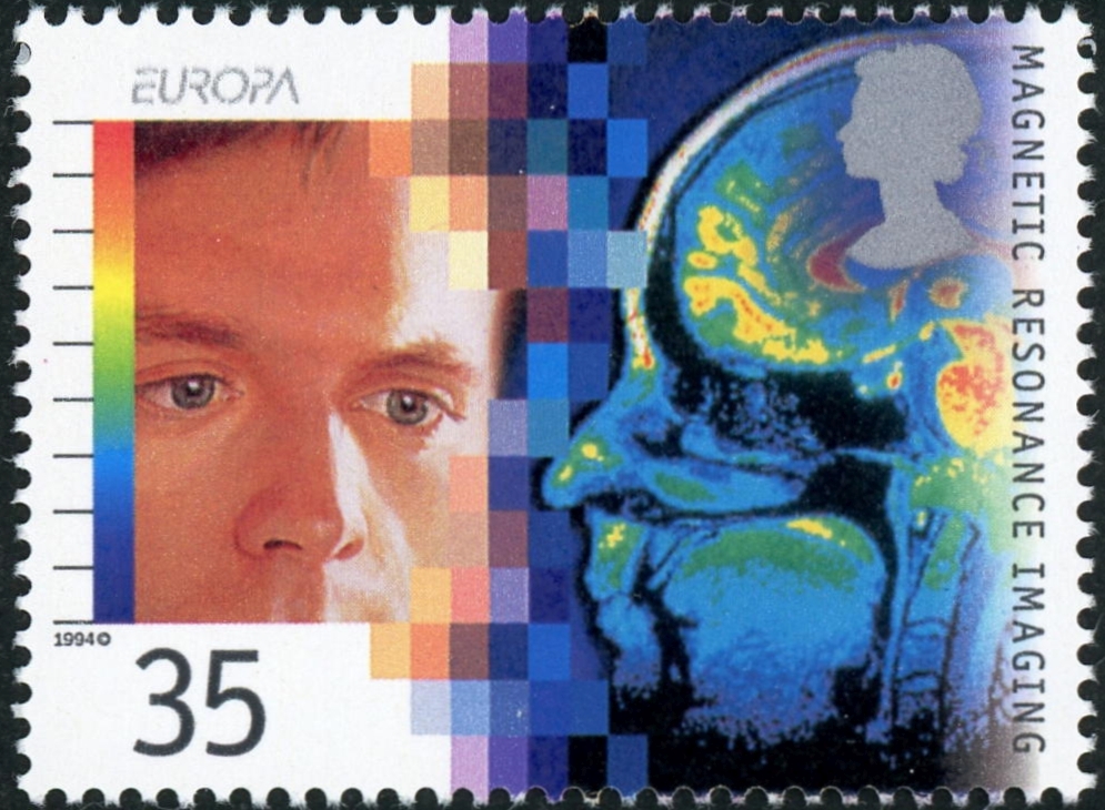 画像診断の切手5：イギリス（1994年発行）—MRIによる頭部診断