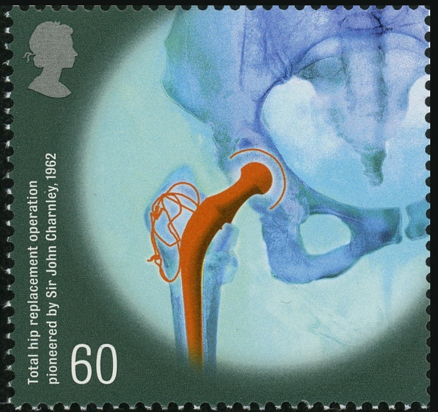 治療を目的とした医療器具の切手04_イギリス（2010年発行）—人工関節のX線写真